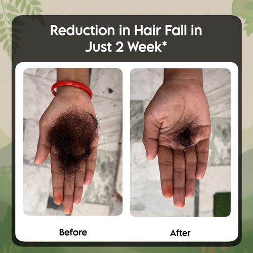 DeepSuhani Shuddh Ayurvedic Hair Oil INDIA'S NO 1 Ayurvedic Hair Oil