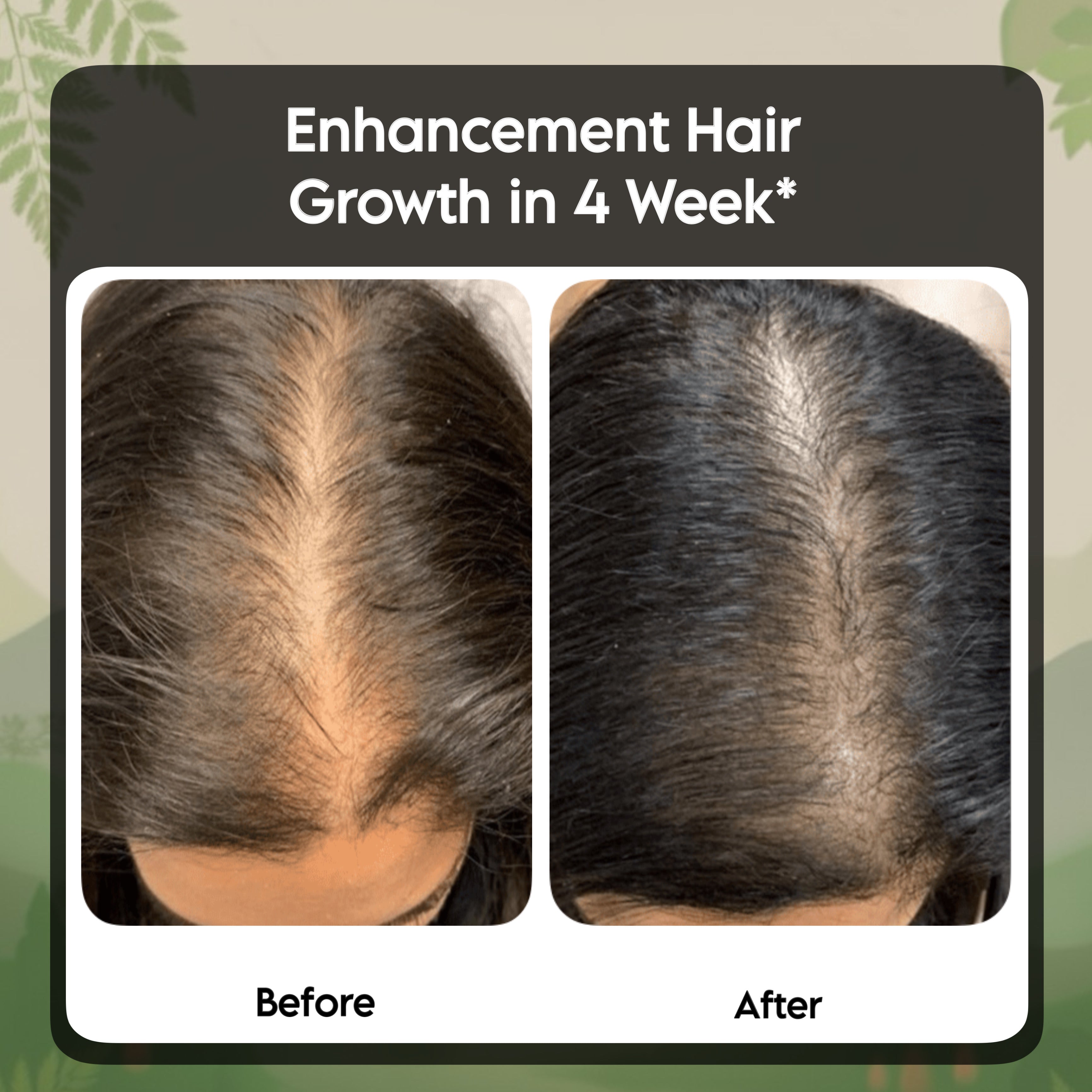 DeepSuhani Shuddh Ayurvedic Hair Oil INDIA'S NO 1 Ayurvedic Hair Oil